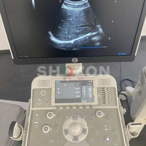 Esaote MyLab X5 Ultrasound Imaging