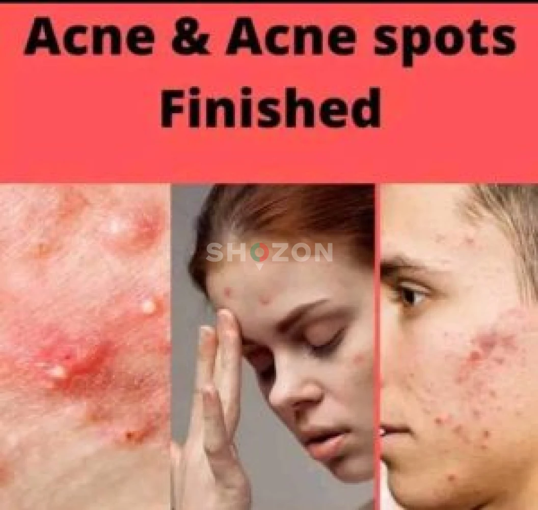 Maonas Acne &  Darkspots Cream