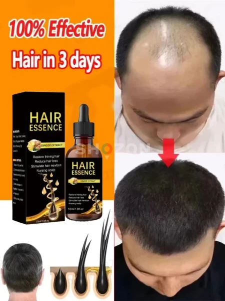hair growth oil 100% result in 1 week 